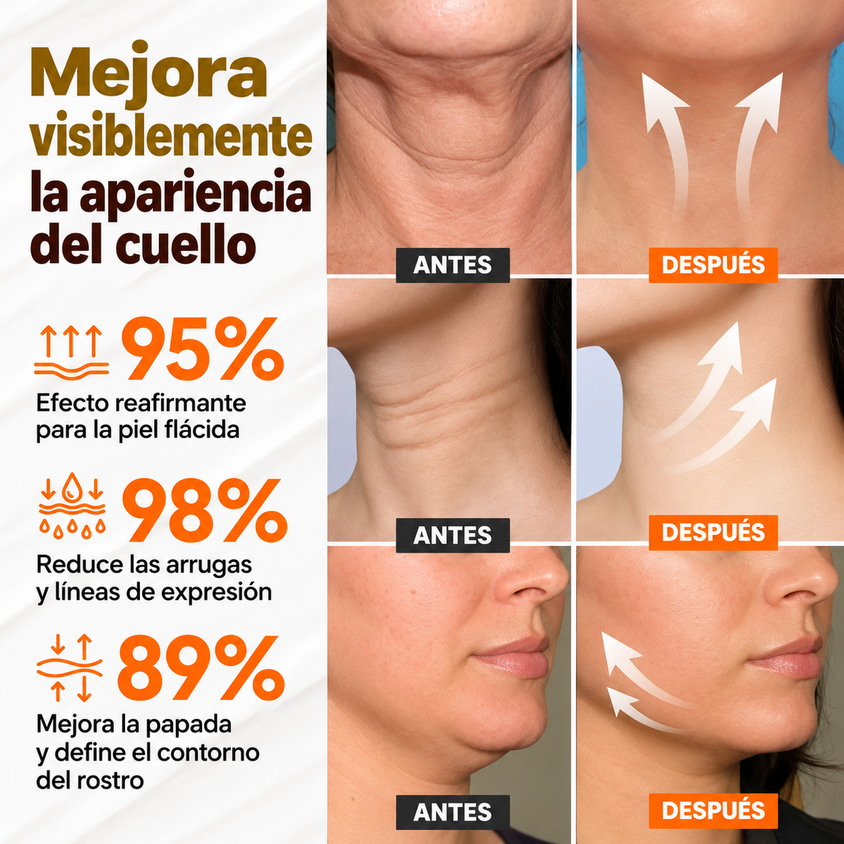 Crema Reafirmante para Cuello AH-8 Lift